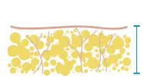reducing_img001