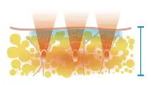 reducing_img002