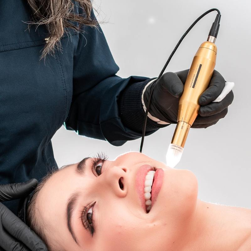 Microneedling en Bucaramanga - Dra. Lina Cadena